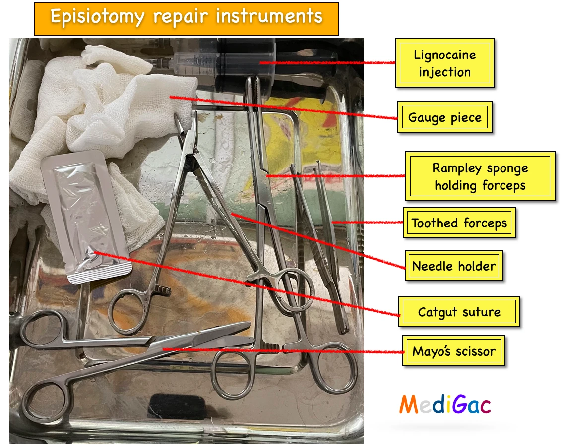 Episiotomy repair set